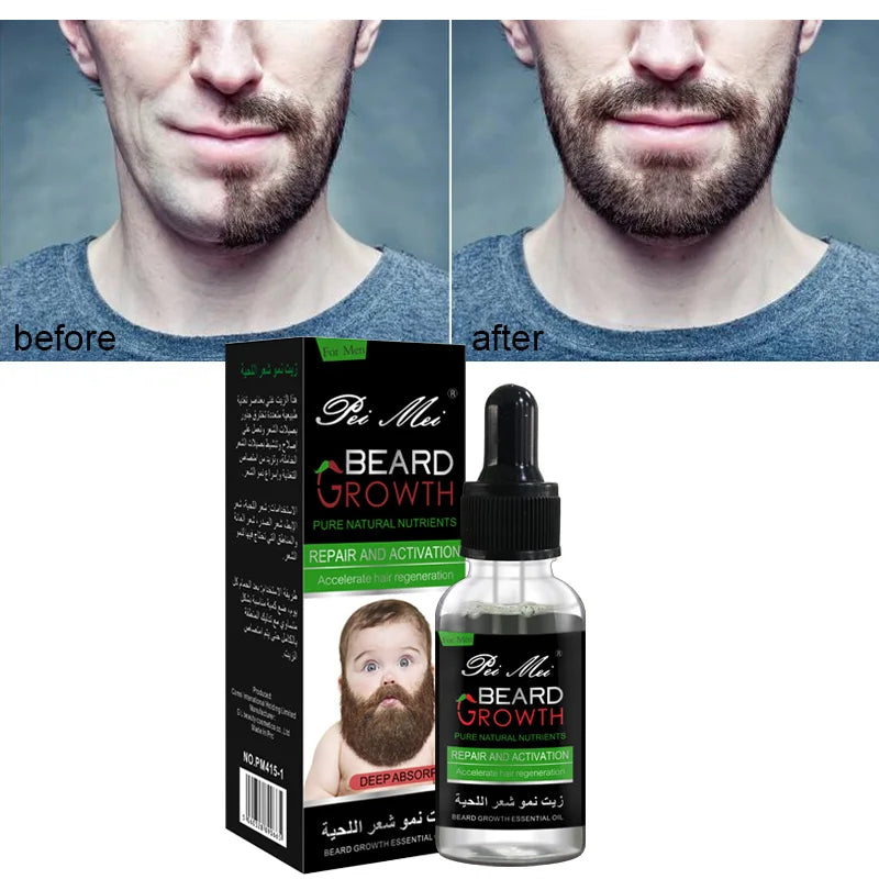Potenciador profesional del crecimiento de la barba para hombres – Aceite esencial para barba, nutrición facial, crecimiento de bigote, kit fortalecedor