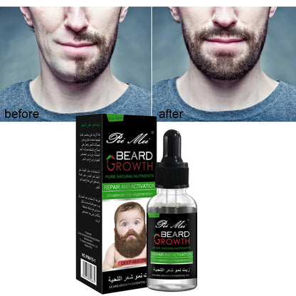 Potenciador profesional del crecimiento de la barba para hombres – Aceite esencial para barba, nutrición facial, crecimiento de bigote, kit fortalecedor